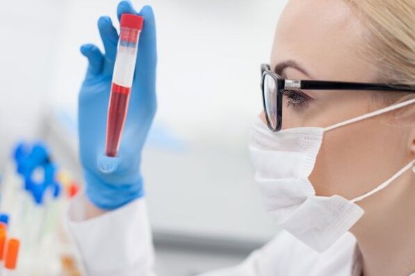 blood tests for hypertension